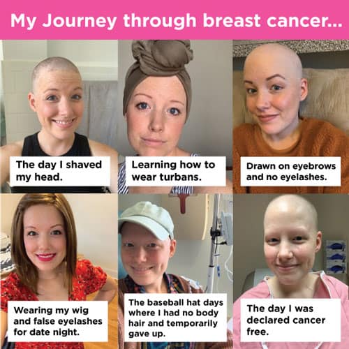 Looking Back, I See My Strong, Resilient Self At Each Stage Of Breast  Cancer Treatment - Susan G. Komen®