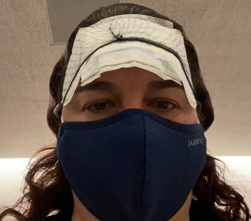 breast cancer survivor Maty cold-capping. 