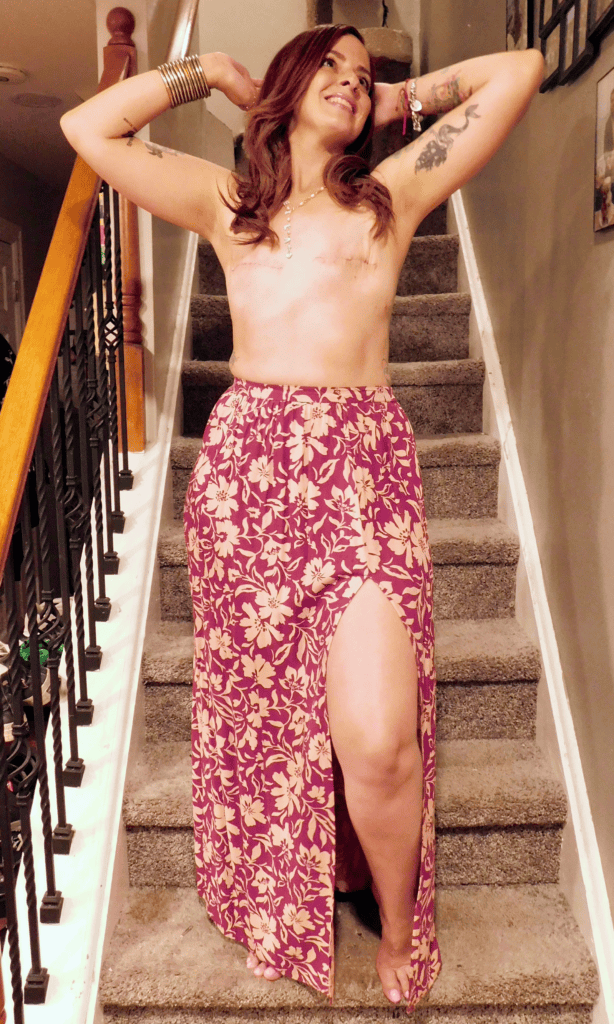 A woman with visible mastectomy scars, celebrating her aesthetic flat closure after breast cancer, stands on carpeted stairs, smiling with arms raised. She wears a floral skirt with a slit and gold bangles. Family photos line the wall beside her.