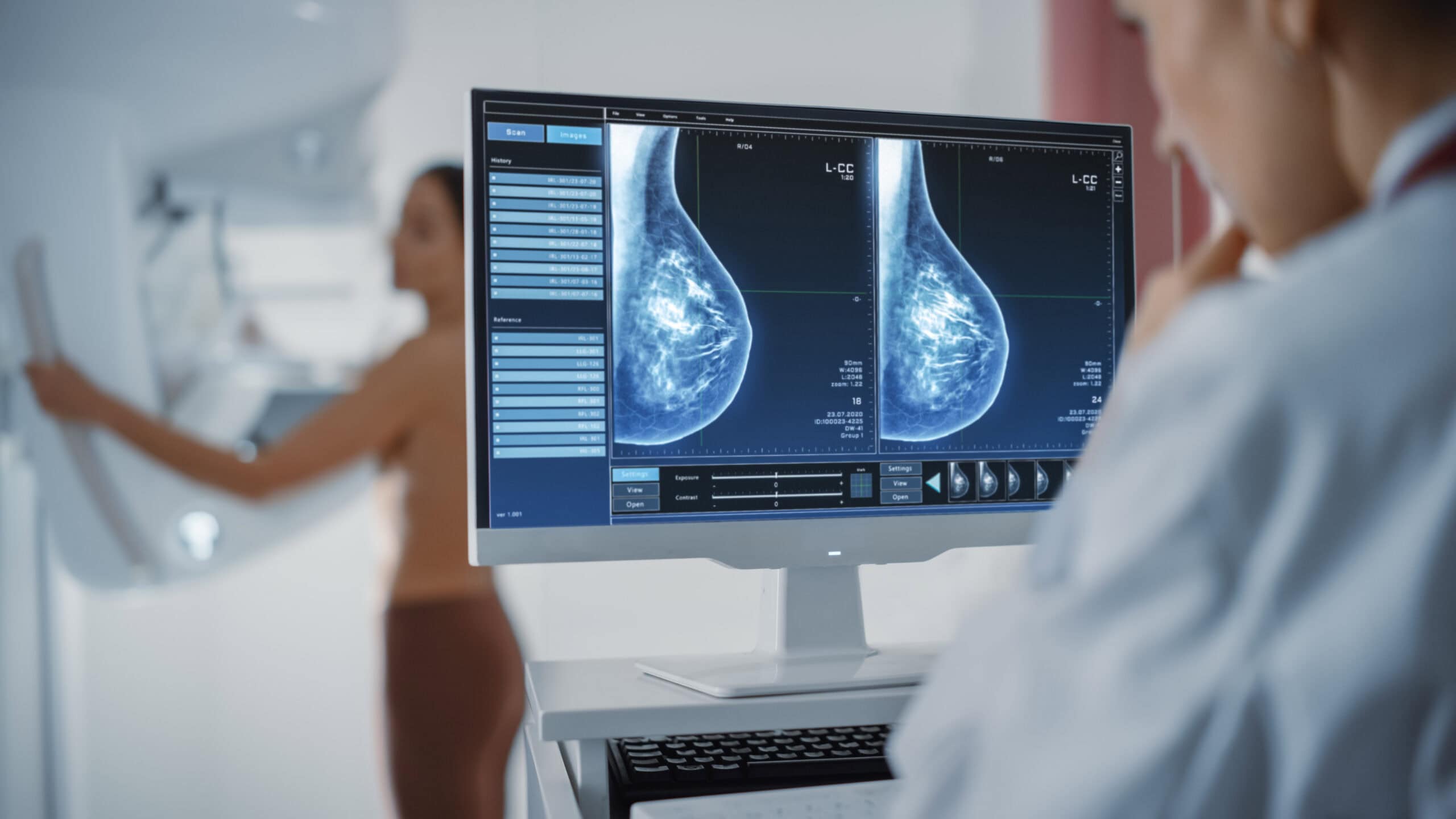 All You Need to Know About AI-Assisted Mammograms - Susan G. Komen®